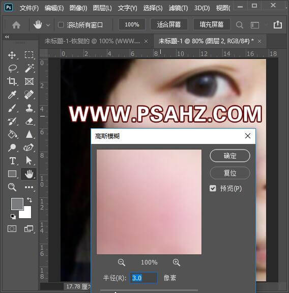 PS云痘美容教程：利用高低频分离来对长痘的脸进行修复。