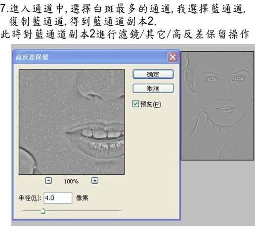 PS通道对多斑人物照片磨皮美白