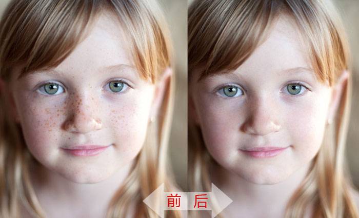 PS软件怎么修补女孩照片脸上斑点